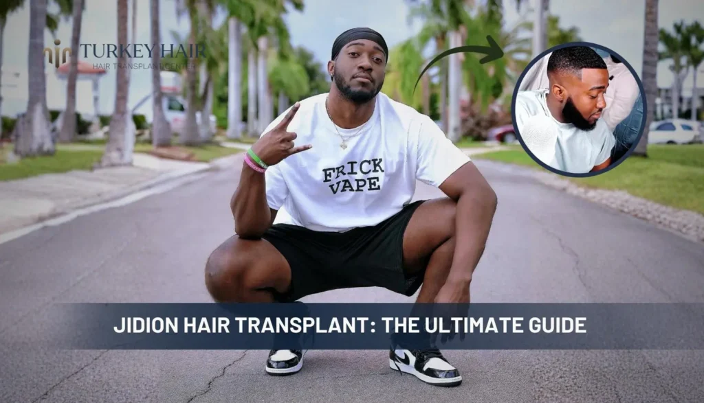 Jidion-Hair-Transplant-1024X587 Rumors About Jidion Hair Transplant Before And After