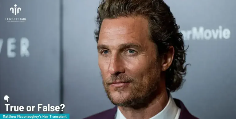 Matthew-Mcconaughey-6-1-768X390 America’s #1 Producer Matthew Mcconaughey Hair Transplant