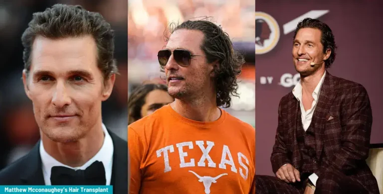 Matthew-Mcconaughey-7-1-768X390 America’s #1 Producer Matthew Mcconaughey Hair Transplant