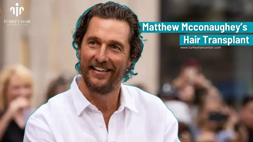 America’s #1 Producer Matthew Mcconaughey Hair Transplant