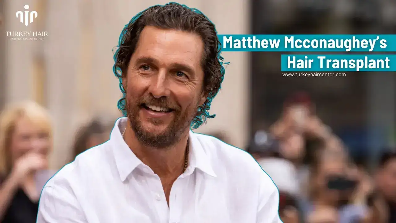 America’s #1 Producer Matthew Mcconaughey Hair Transplant 1 America’s #1 Producer Matthew Mcconaughey Hair Transplant