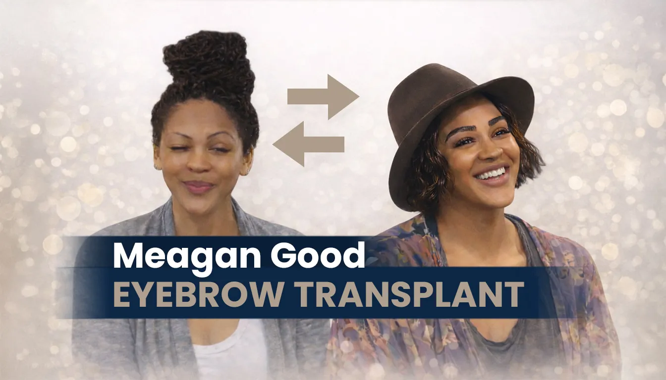 Meagan Good Eyebrow Transplant Before And After