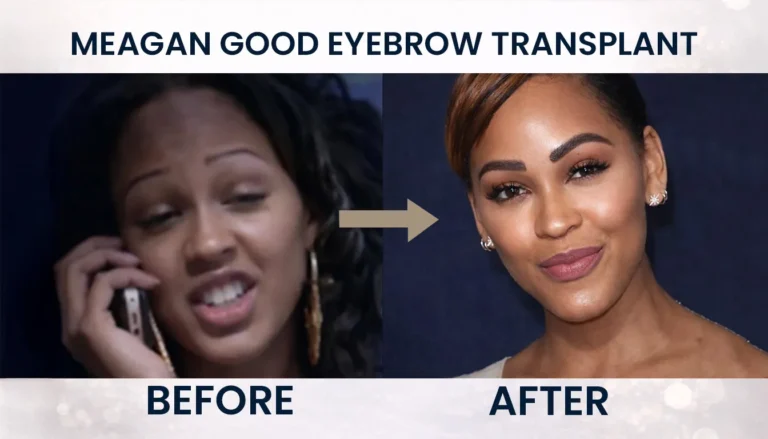 Meagan-Goods-Microblading-Phase-768X439 Meagan Good Eyebrow Transplant Before And After
