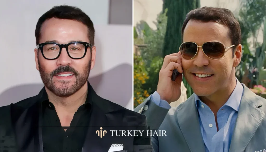 Natural-Look-Hair-Direction-And-Symmetry-1344X768 Jeremy Piven Hair Transplant – Before And After