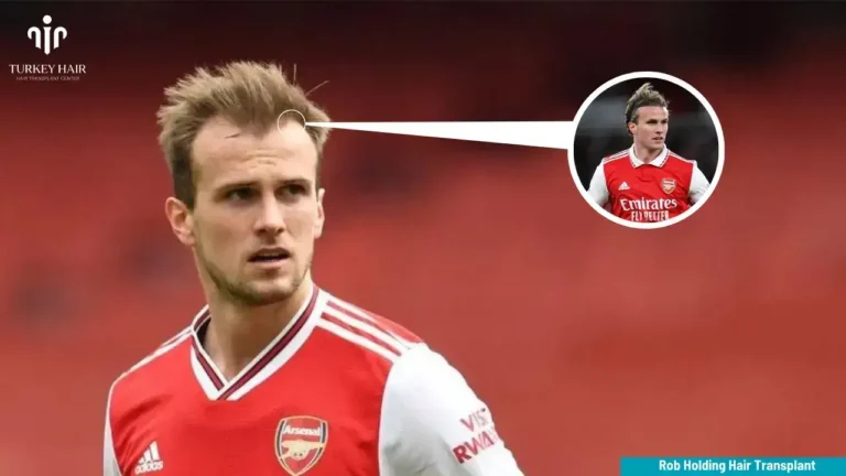 Rob-Holding-Hair-Transplant-2-1-768X432 Rob Holding Hair Transplant