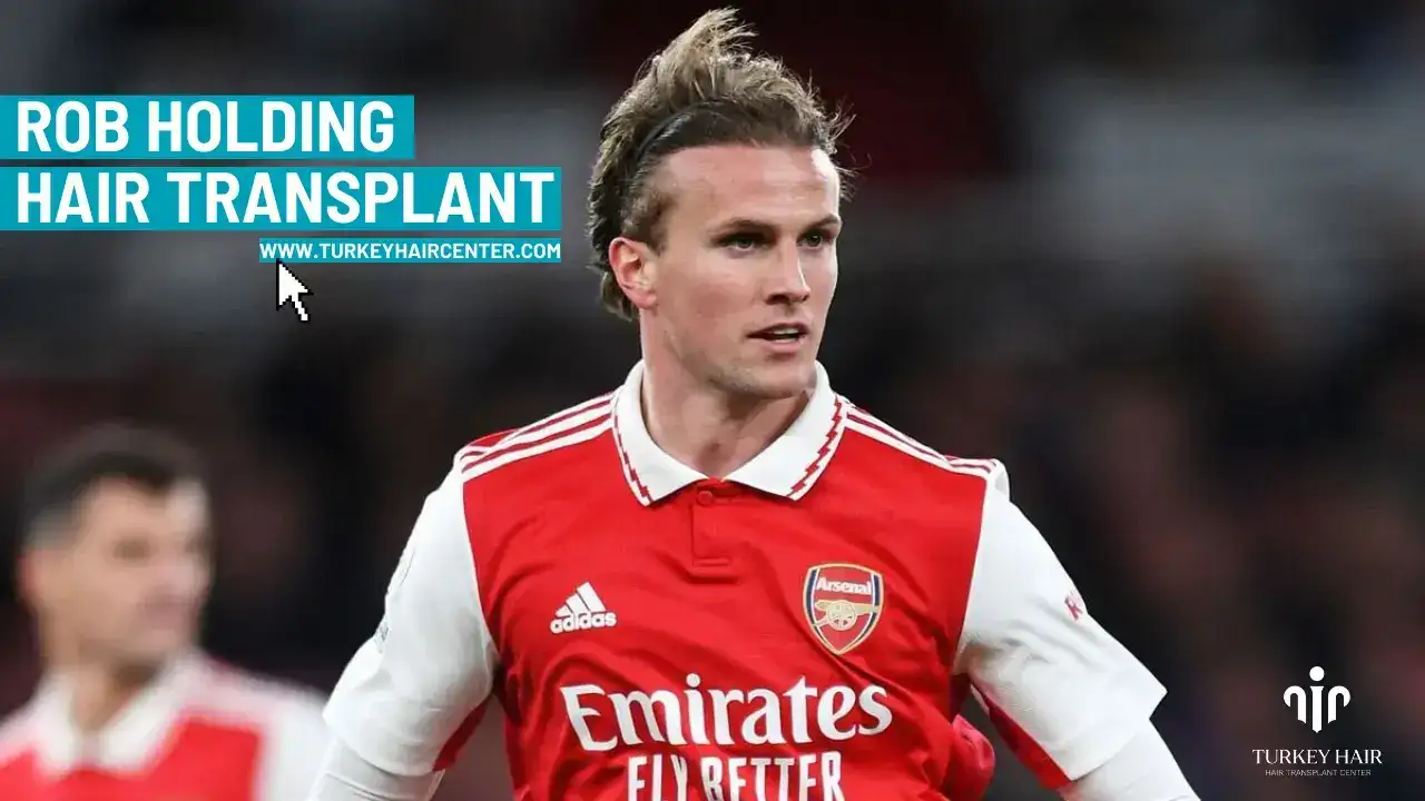 Rob Holding Hair Transplant 1 Rob Holding Hair Transplant