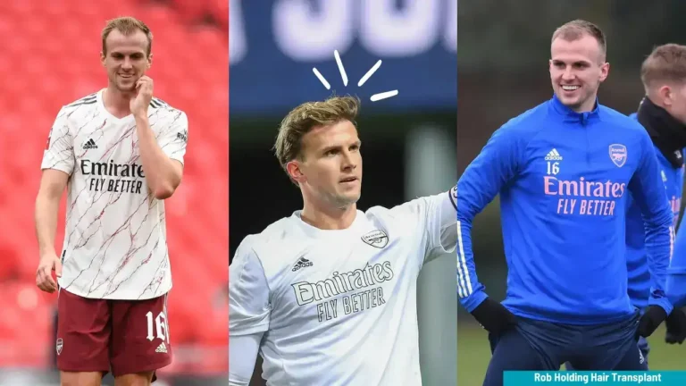 Rob-Holding-Hair-Transplant-6-1-768X432 Rob Holding Hair Transplant