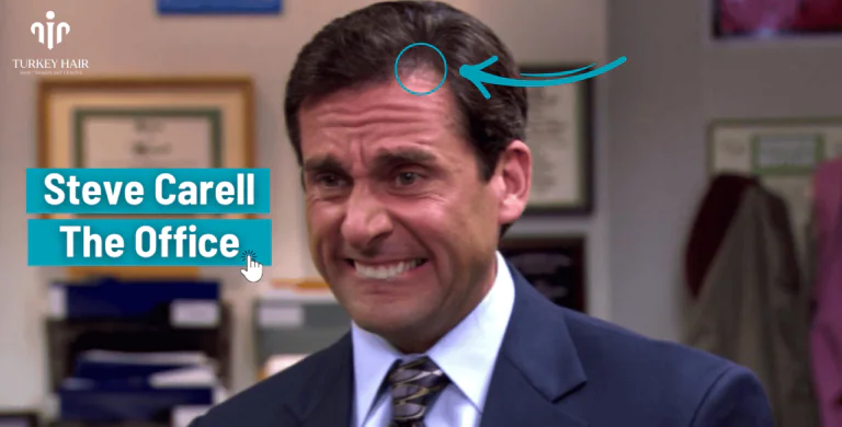 Steve-Carells-Hair-Transplant-2-768X390.Png #1 Actor Steve Carell’s Hair Transplant