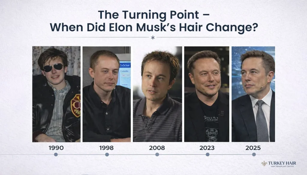 The-Turning-Point-When-Did-Elon-Musks-Hair-Change- Elon Musk Hair Transplant Success Story: Before And After