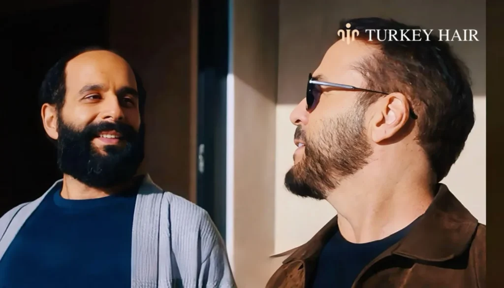 Was-Jeremy-Pivens-Hair-Transplant-Successful-1344X768 Jeremy Piven Hair Transplant – Before And After