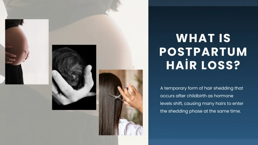 What-Is-Postpartum-Hair-Loss Postpartum Hair Loss Guide: Causes, Recovery And Healthy Regrowth