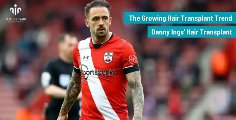 Danny-Ings-Hair-Transplant-5-1-768X390 Let’s Discover Succesfull Striker Danny Ings’ Hair Transplant 2026
