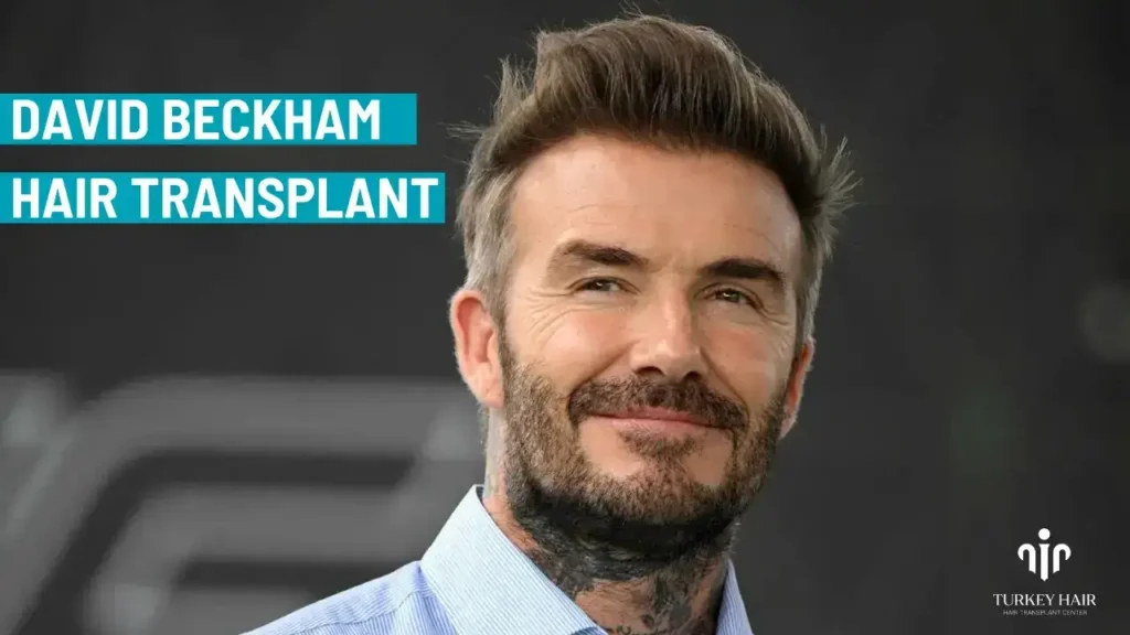 David-Beckham-Hair-Transplant-4-1 David Beckham