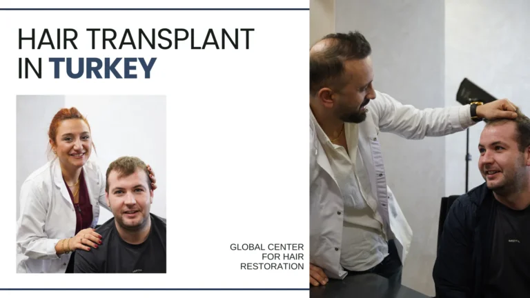 Hair-Transplant-In-Kuwait-2-768X432 Hair Transplant Kuwait Vs Turkey – Cost, Quality And Facts Hair Restoration Excellence You Can Trust