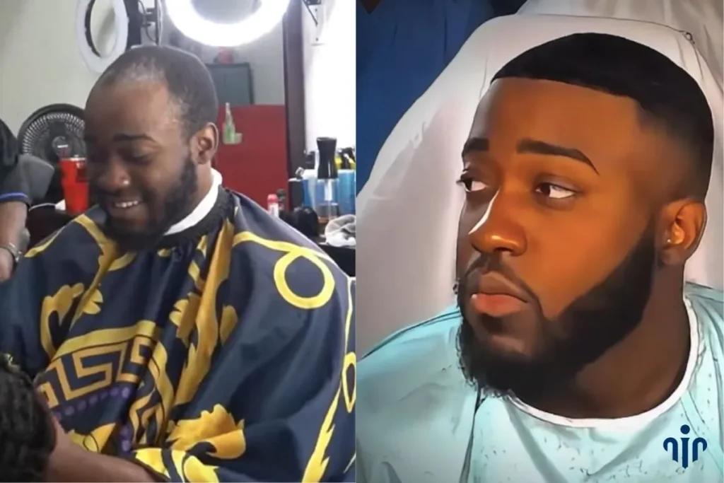 Jidion-Hair-Before-After.jpg Rumors About Jidion Hair Transplant Before And After