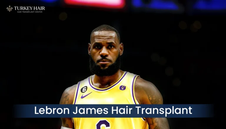 Lebron-James-Hair-Transplant-768X439 Lebron James Hair Transplant Journey: From Hair Loss To Full Comeback