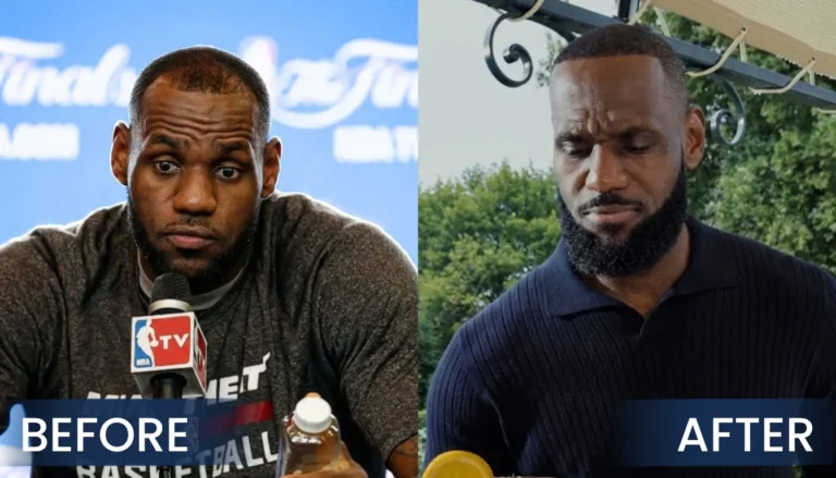 Lebron-James-Hair-Transplant-Real-Life-Before-After-768X439 Lebron James Hair Transplant Journey: From Hair Loss To Full Comeback