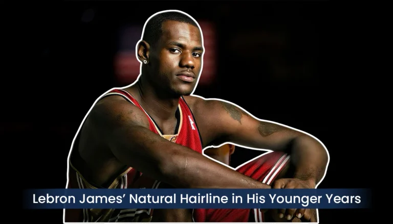 Lebron-James-Young-Nba-Years-Natural-Hairline-768X439 Lebron James Hair Transplant Journey: From Hair Loss To Full Comeback