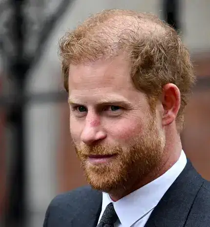Join To Prince Harry Hair Transplant Journey
