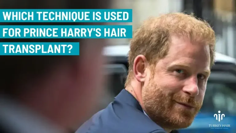 Join To Prince Harry Hair Transplant Journey