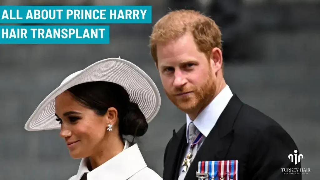 Join To Prince Harry Hair Transplant Journey