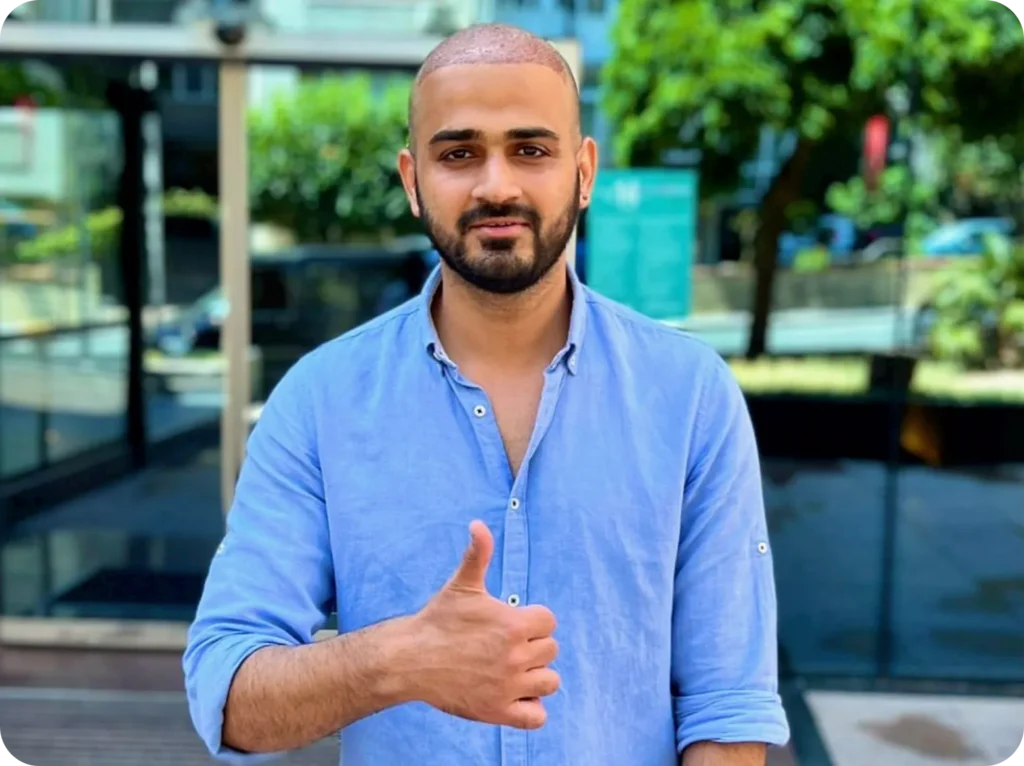 7 Days After Hair Transplant Hair Transplant 7 Days After Procedure Healing Stage