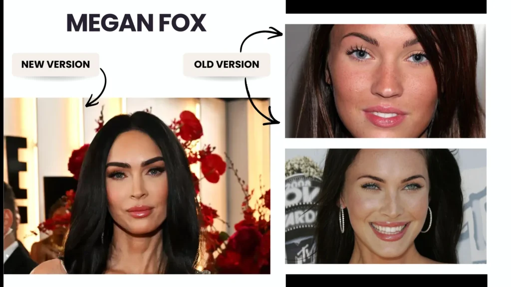 Eyebrow Transplant In Turkey – Cost, Before &Amp; After 12 Eyebrow Transplant In Turkey – Cost, Before &Amp; After Hair Restoration Excellence You Can Trust