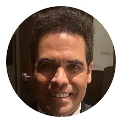 Aaron Exsome Hair Transplant Before And After Result