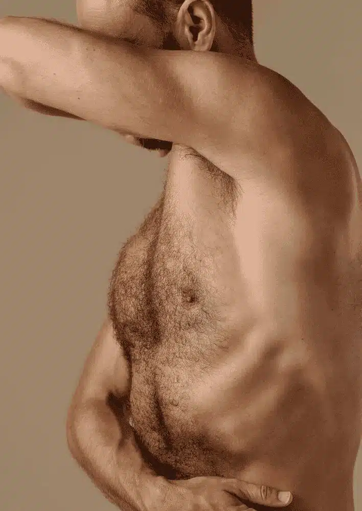 Body-Hair-Transplant-01 Body Hair Transplant