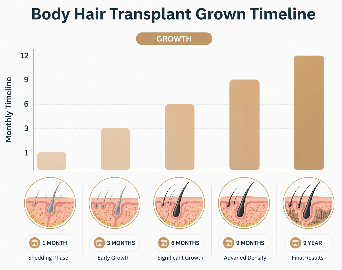 Body Hair Transplant In Turkey: Cost, Procedure &Amp; Before-After 10 Body Hair Transplant In Turkey: Cost, Procedure &Amp; Before-After Hair Restoration Excellence You Can Trust