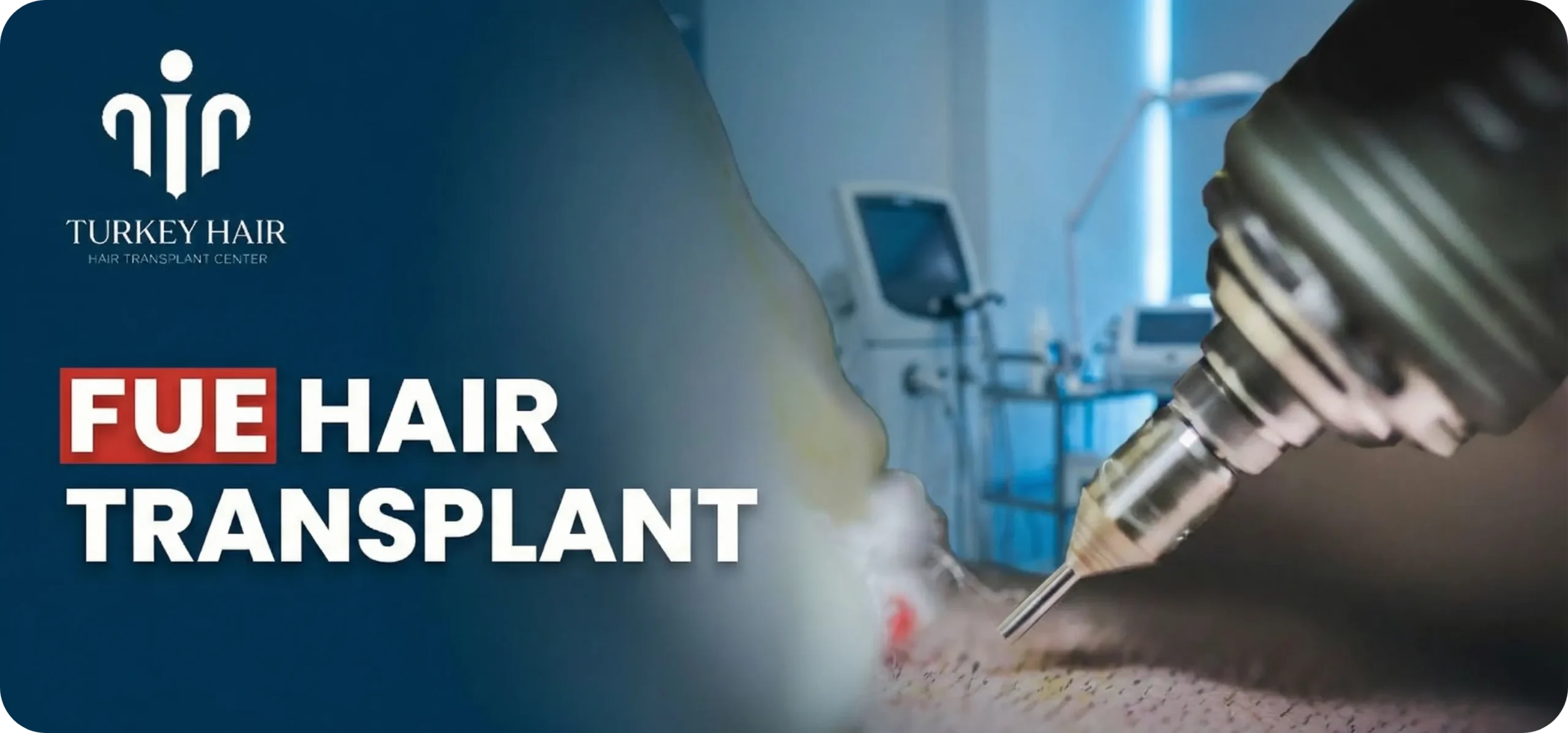 Fue Hair Transplant In Turkey – Cost, Before &Amp; After