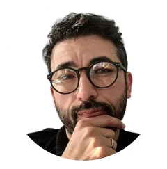 Daniel Dhi Hair Transplant Before And After Result