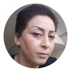 Victoria Female Hair Transplant Before And After Result