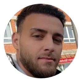 Connor Exsome Hair Transplant Before And After Result