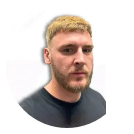 Andrew Dhi Hair Transplant Before And After Result 2