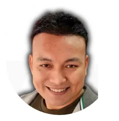 Cole Exsome Hair Transplant Before And After Result 2