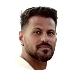 Matthew Dhi Hair Transplant Before And After Result