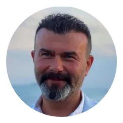 Kevin Fue Hair Transplant Before And After Result