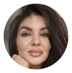 Raluca Female Hair Transplant Before And After Result 2