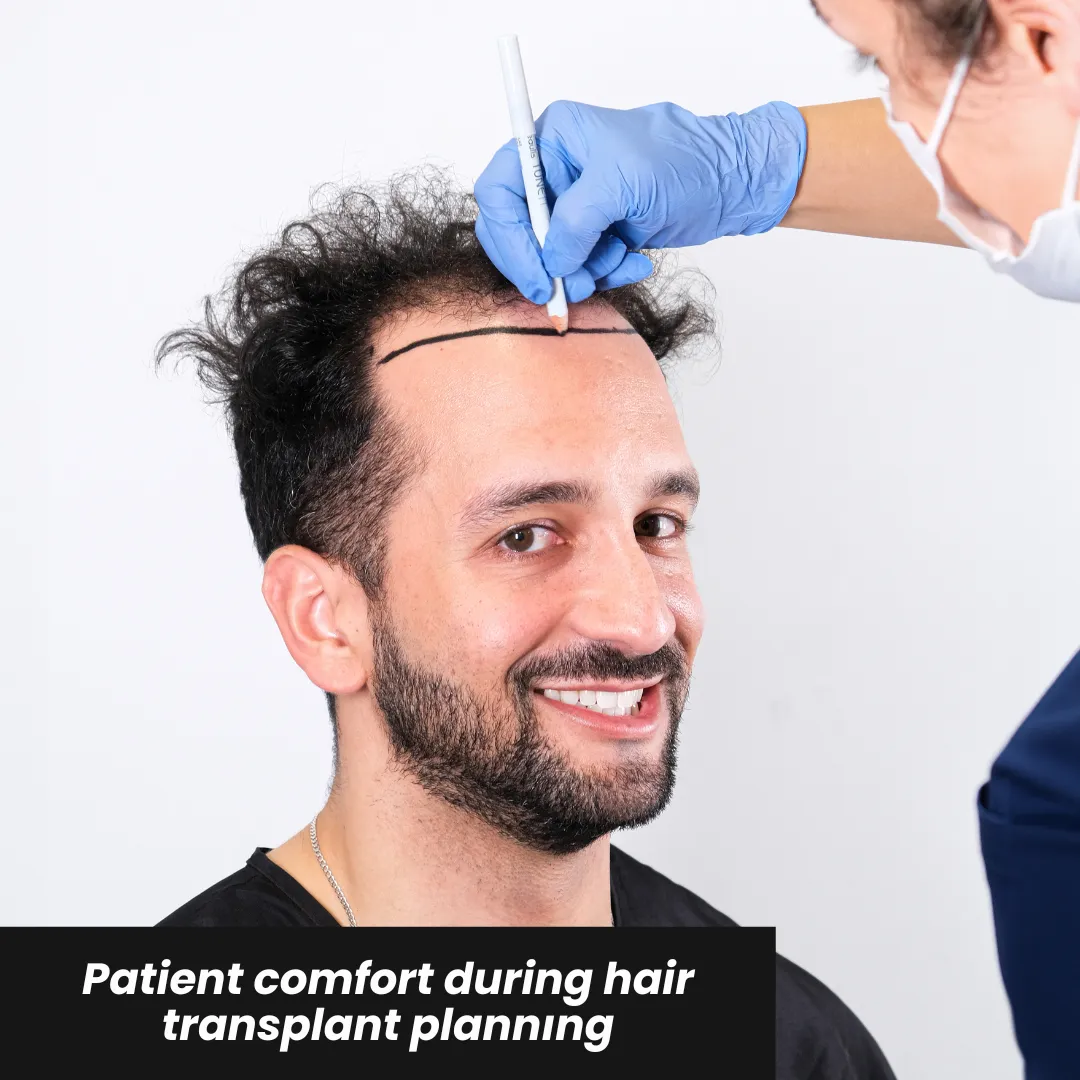 Sedated Hair Transplant 7 Sedated Hair Transplant