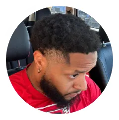 Brandon A. Dhi Hair Transplant Before And After Result