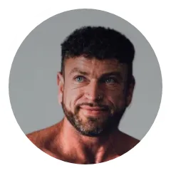 David Fue Hair Transplant Before And After Result 2