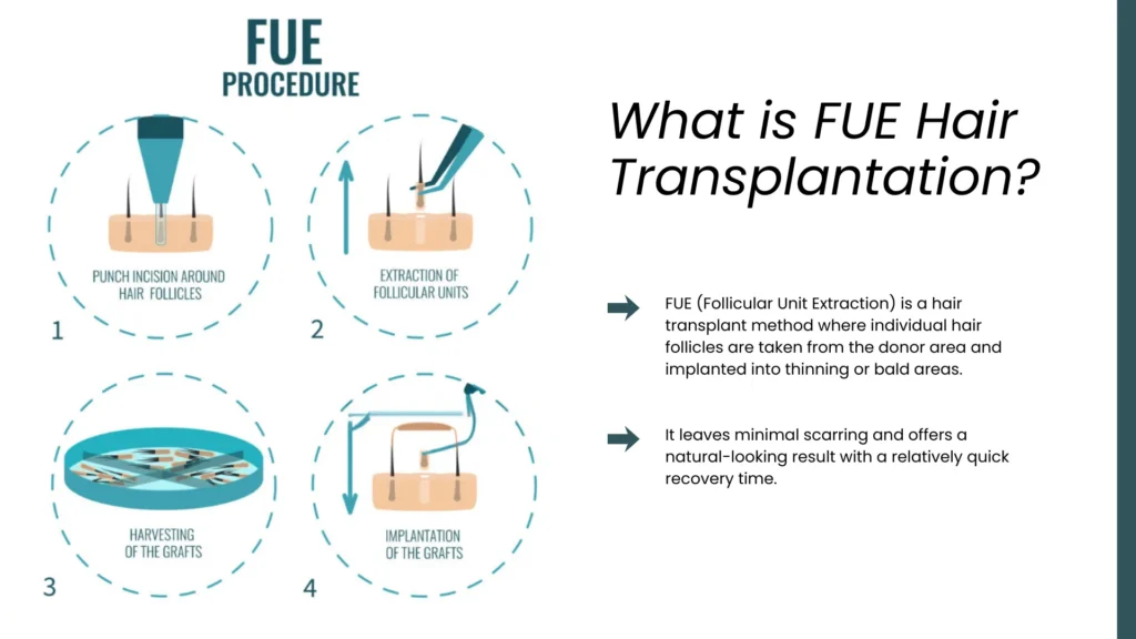 Fue Hair Transplant Technique With Follicle Extraction And Implantation For Natural Hair Restoration