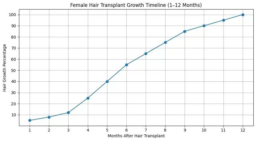 Female Hair Transplant In Turkey – Cost – Before And After 7 Female Hair Transplant In Turkey – Cost – Before And After Hair Restoration Excellence You Can Trust