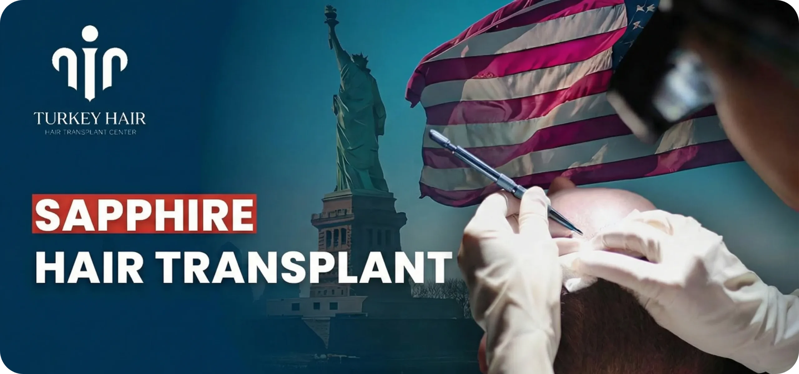 Sapphire Hair Transplant Hair Restoration Excellence You Can Trust