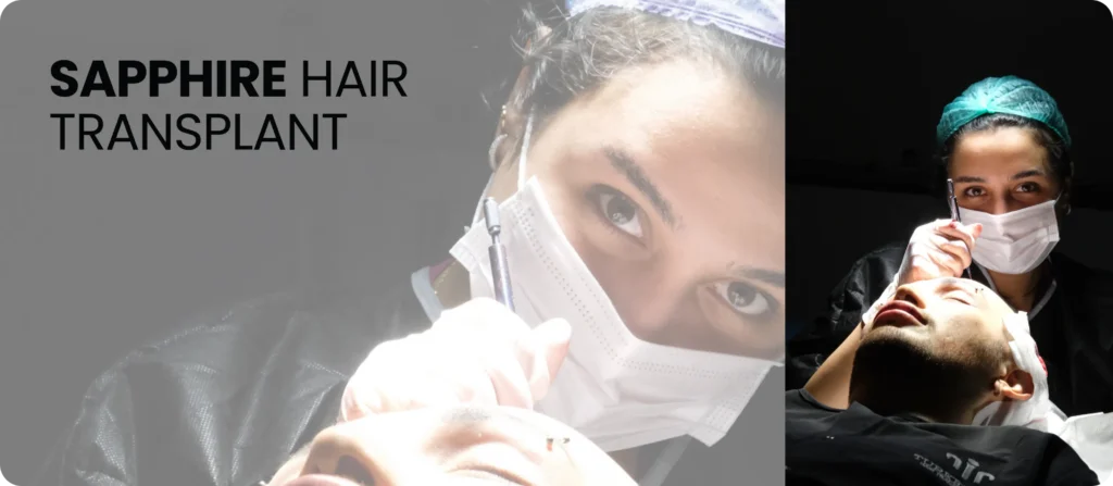 Sapphire Hair Transplant 