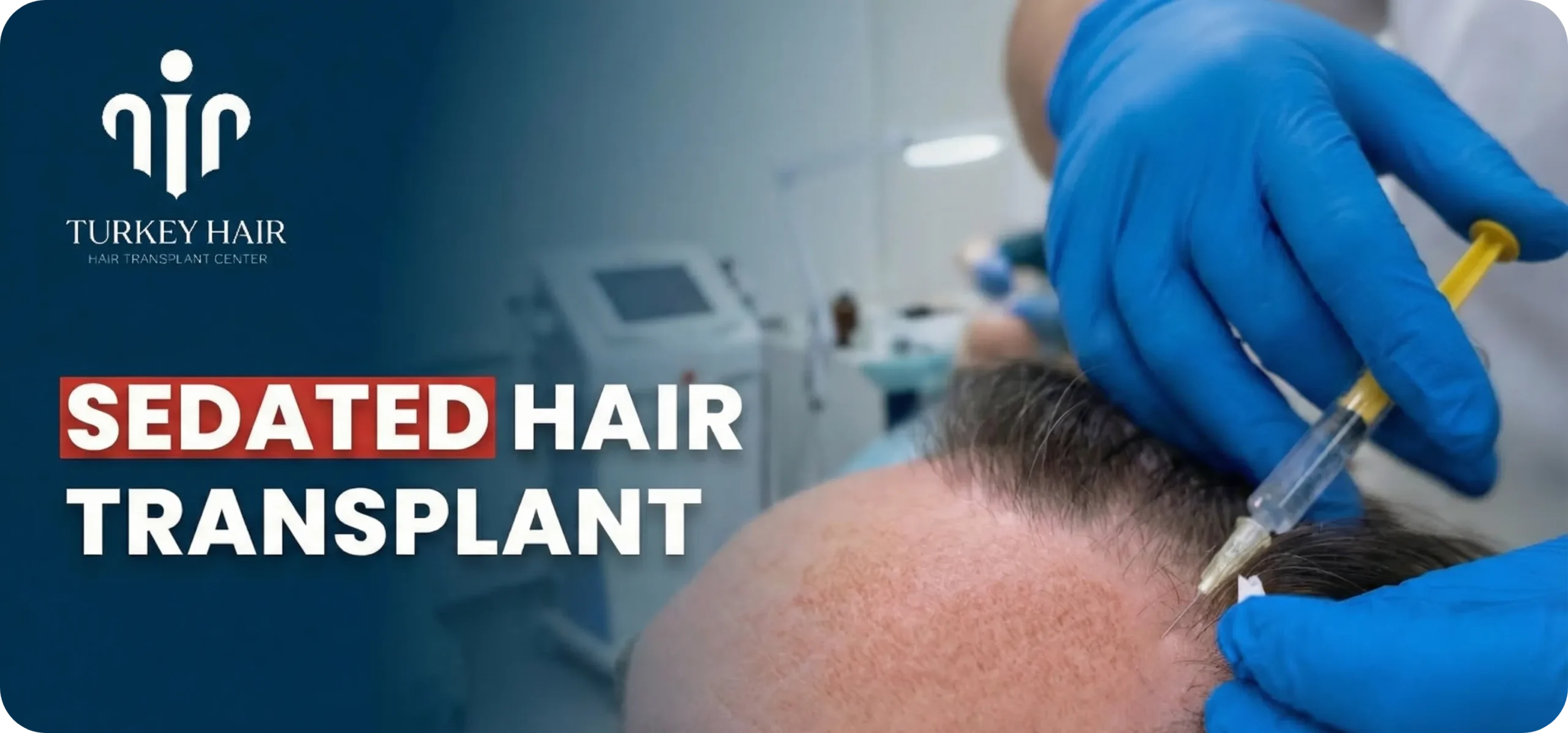 Greffe de cheveux sous sédation, une excellence en matière de restauration capillaire à laquelle vous pouvez faire confiance