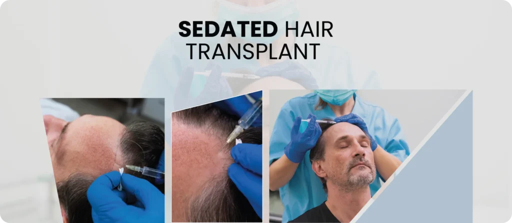 Sedated Hair Transplant