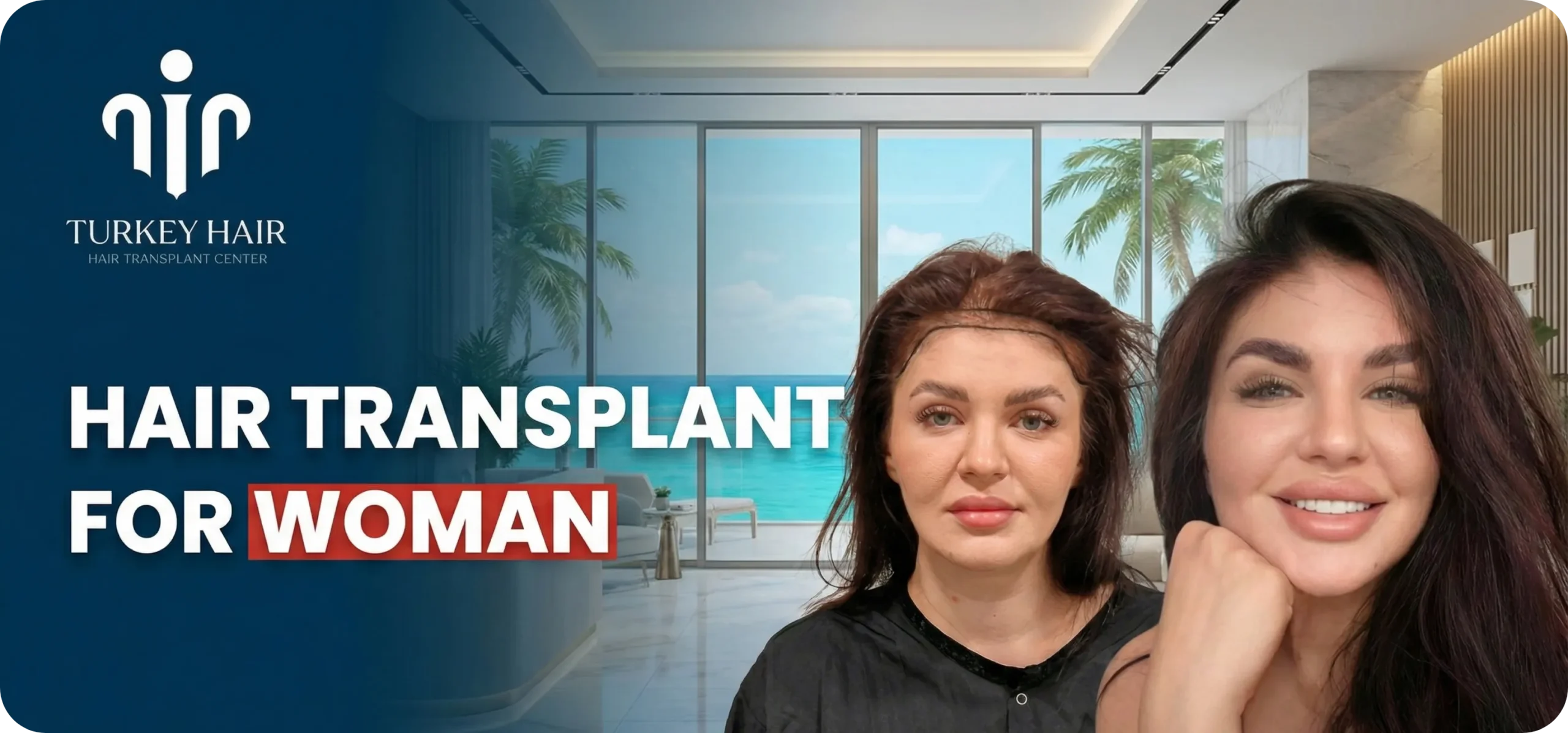 Female Hair Transplant in Uganda – Cost – Before And After Hair Restoration Excellence You Can Trust