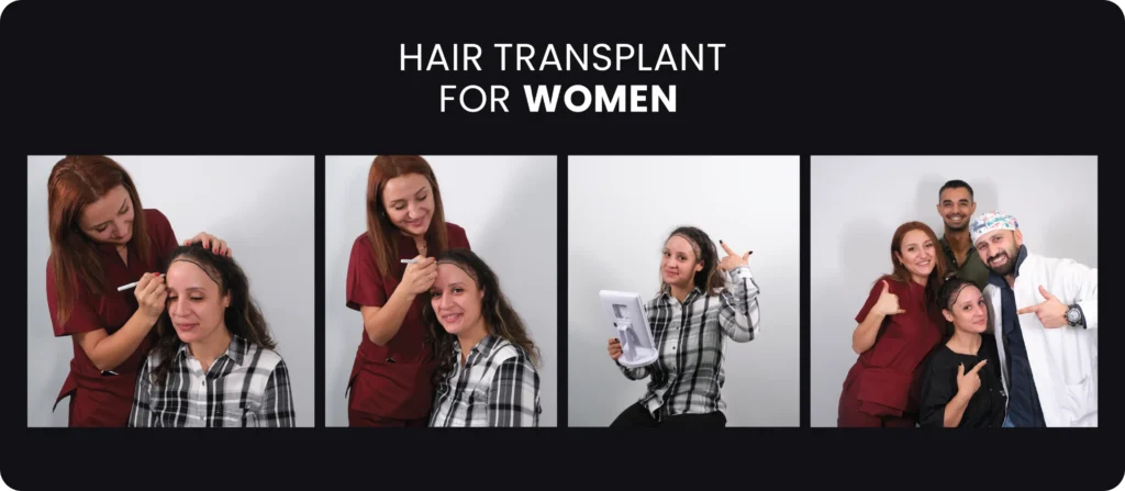 Hair Transplant For Women Hair Transplant For Women